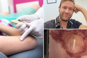 Collage of a man consulting with a doctor about hormonal contraception implant