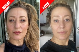 A woman smiling in a selfie after receiving a non-surgical facelift procedure from Dr. Turk, radiating a youthful glow.