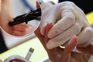 A doctor checks a patient for muscle growth. A doctor pricks a patient's finger to test blood sugar levels.