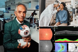 Early signs of dementia could be found in eyes with new AI tool. Here, a an ophthalmologist holding the new AI tool (left), a doctor examining a woman's eyes (top right) and different images of a retina (bottom right).