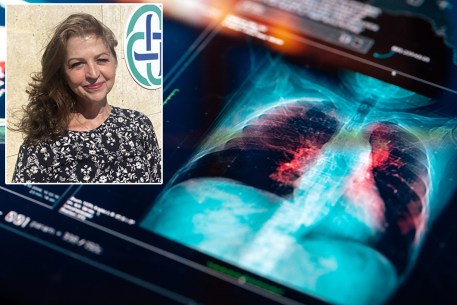 Medical MRI Scan on digital screen with April