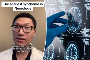 Neurologist Dr. Bing (left) and a gloved hand pointing to a brain scan (right)