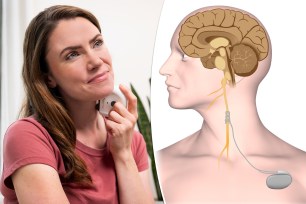 Implantable vagus nerve stimulation devices have long been used to treat epilepsy, depression and stroke. A new crop of buzzy non-invasive VNS gadgets promises to relieve stress and improve sleep.